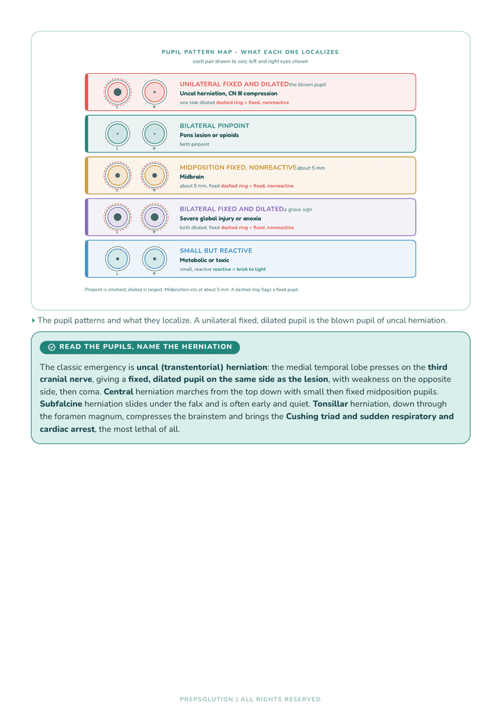 Diagram page from Chapter 8. The pupil pattern map turning neuro findings into one picture